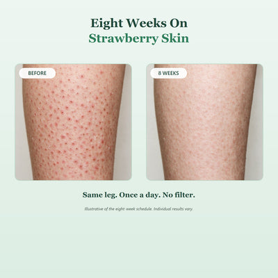 Before and after eight weeks on strawberry skin