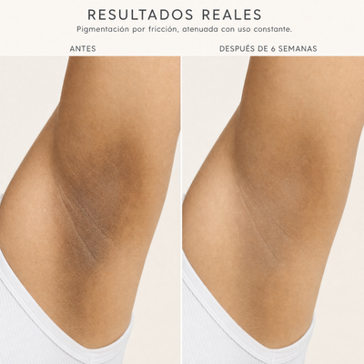 Verra® Aclara