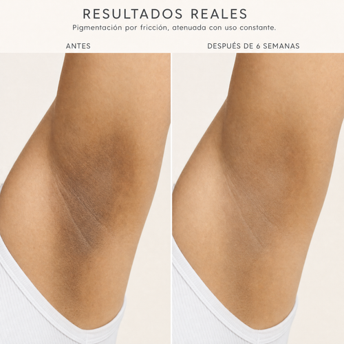 Verra® Aclara
