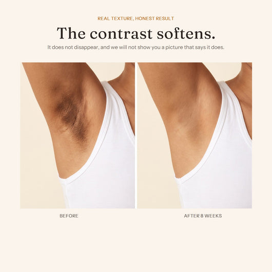 Underarm before and after eight weeks